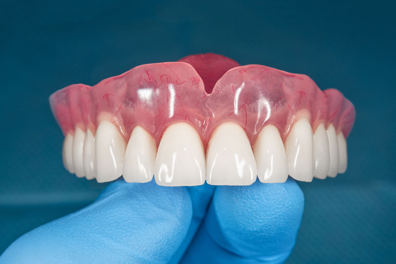 Full Dentures Graphic