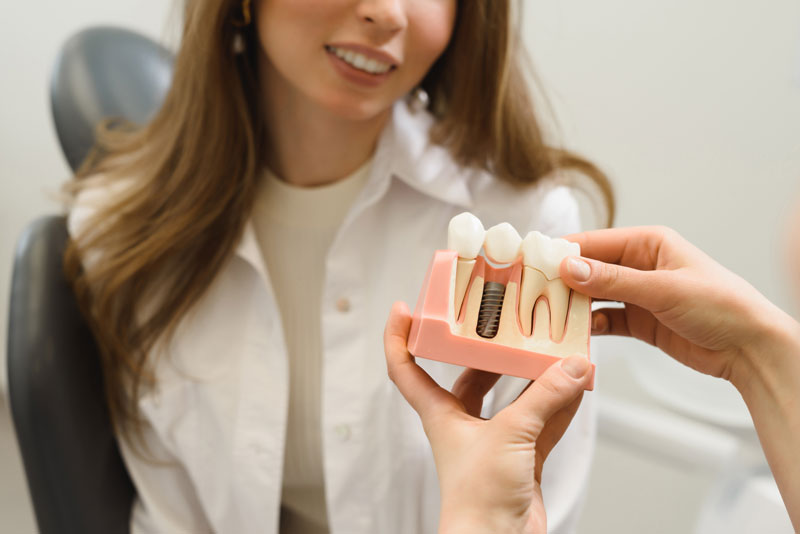 Dental Patient Getting Shown A Dental Implant Model During Her Consultation in San Francisco, CA
